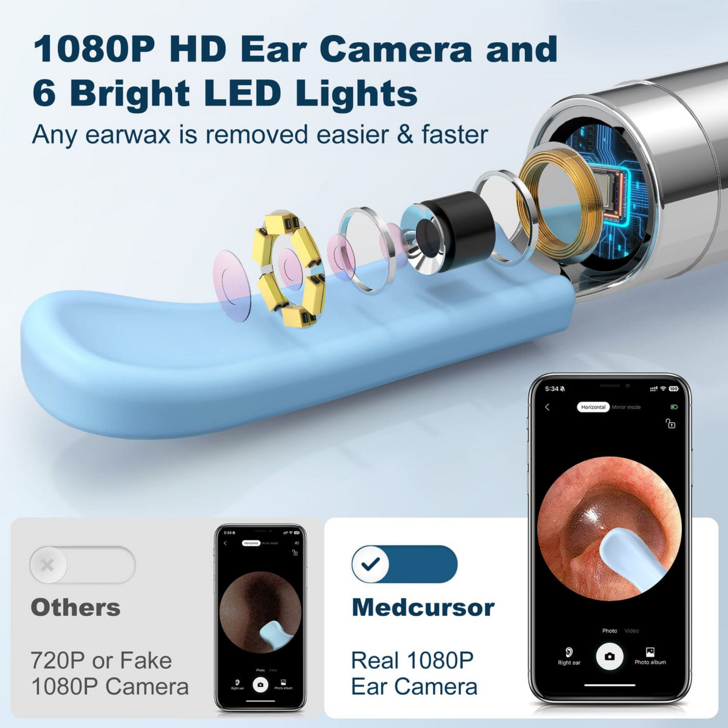 Earcleanixo™️ SmartScope| 1-Year Warranty